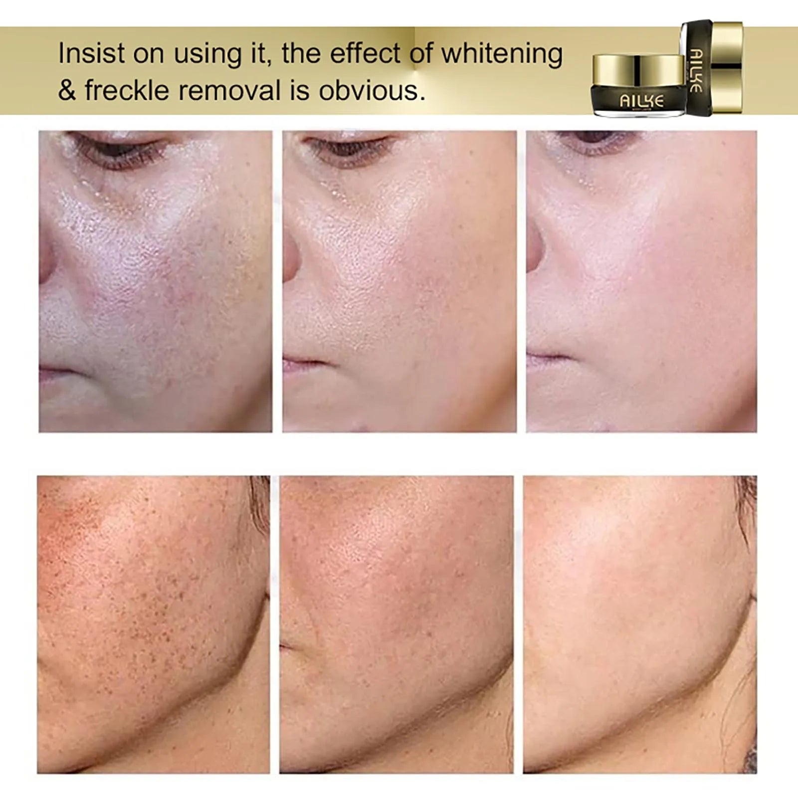 AILKE Whitening Face Cream, Antioxidant, Reduce Dark Spots, Inhibit Melanin, Anti-aging, With Collagen, Niacinamide, Glutathione